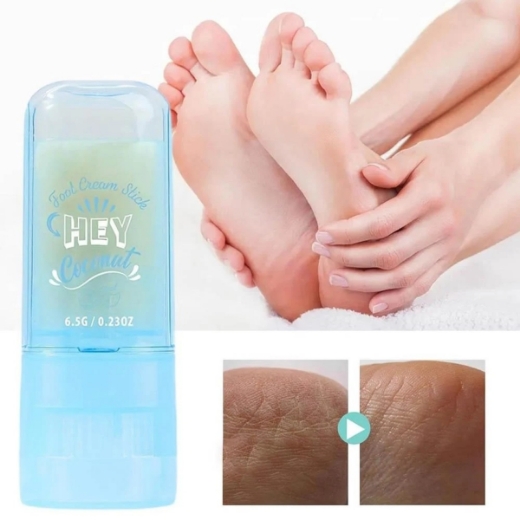 صورة يوشاس كريم القدم  بجوز الهند