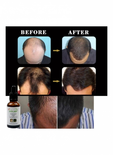 صورة لوف جوجو مضاد لتساقط الشعر 30 مل